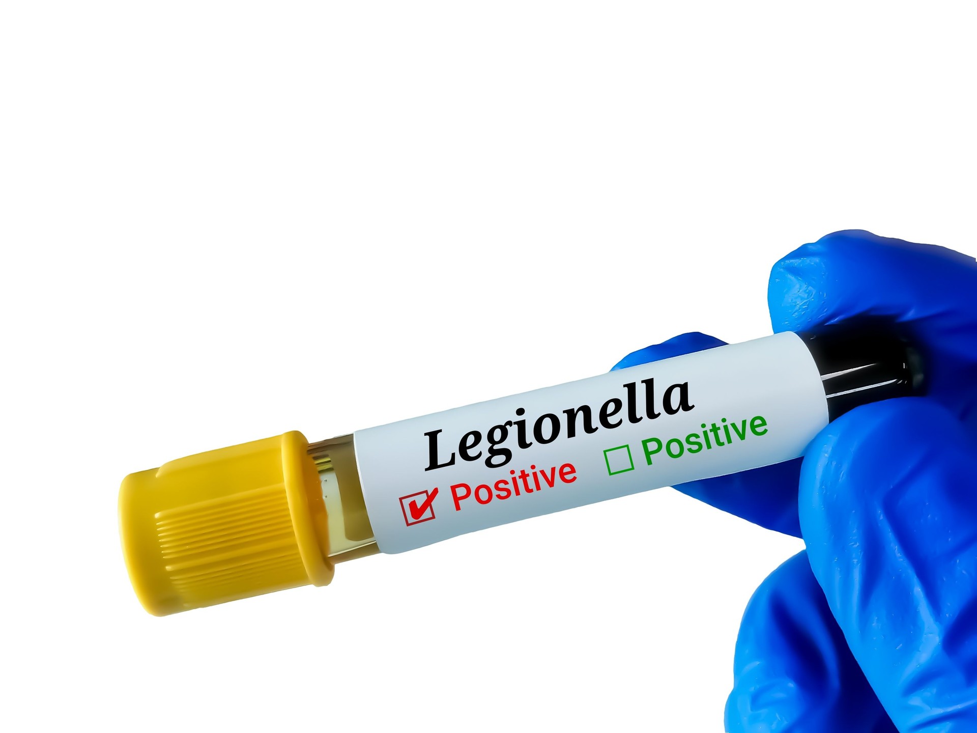 Legionella- Test  order with blood sample. Healthcare or Medical concept